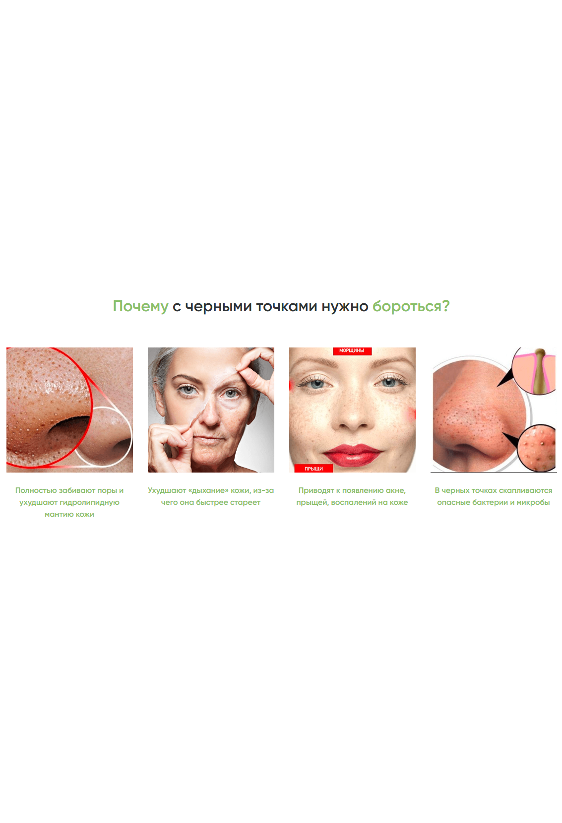 Green Acne Stick - средство для очистки пор_7